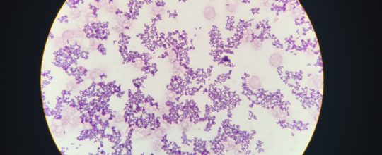 Test for Listeria monocytogenes. Sample prep in Seward Stomacher®